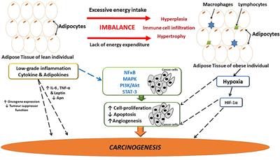 Chemoresistance: Intricate Interplay Between Breast Tumor Cells and Adipocytes in the Tumor Microenvironment